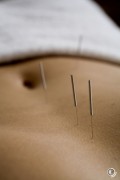 Körper-Akupunktur